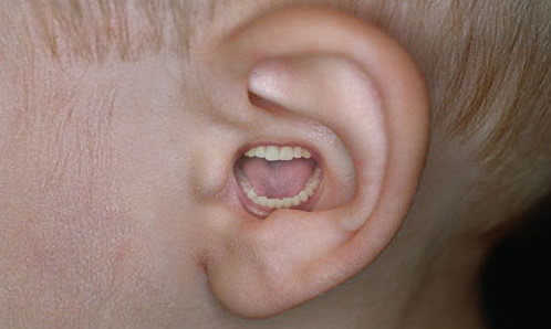Mouth And Ear 91